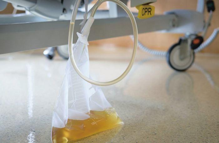 插尿管后为什么会觉得尿急,儿童拔了尿管后疼痛而且尿意频繁