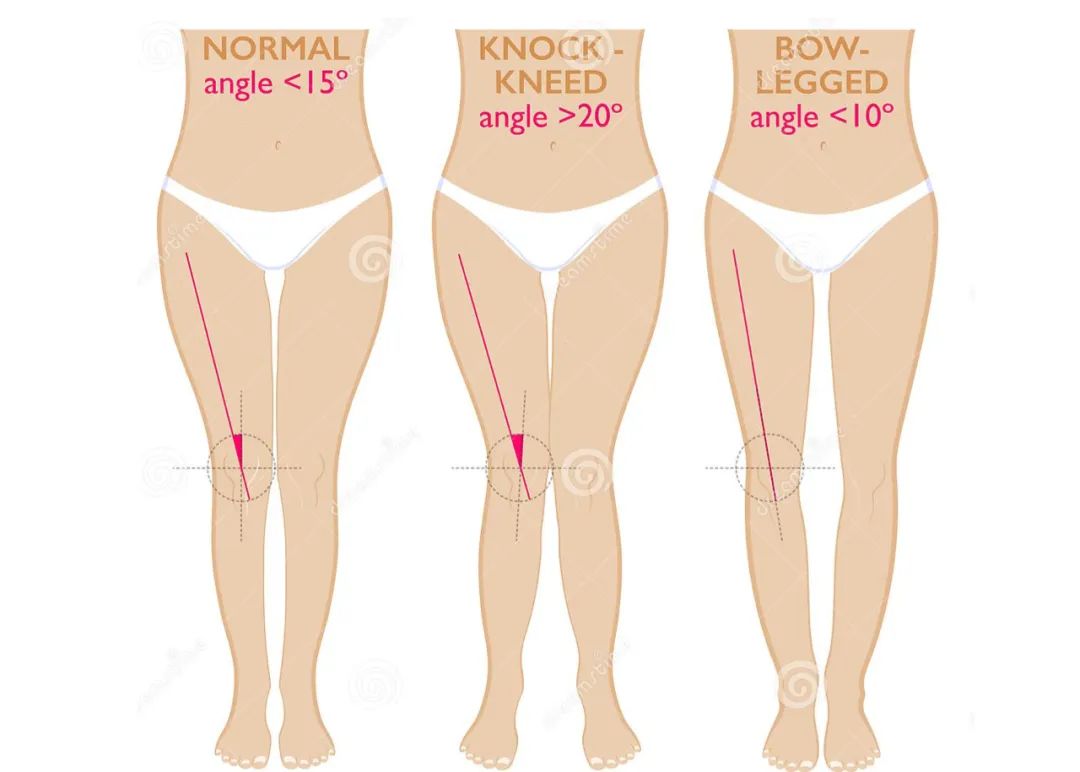 小个子胯宽腿粗牛仔裤,适合假胯宽的牛仔裤