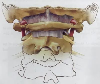 寰枢椎半脱位与痉挛性斜颈,寰枢椎发育畸形