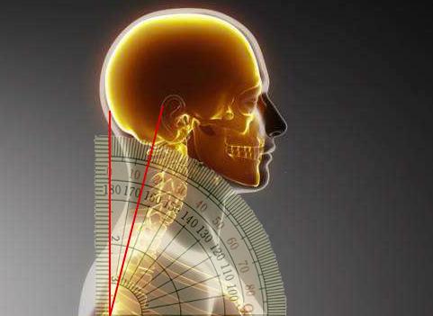 颈椎牵引器锻炼老人,每天30分钟颈椎牵引器