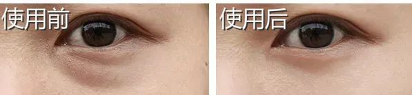 国货眼霜马应龙八宝,马应龙去黑眼霜官方旗舰店