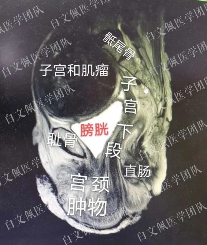 盆腔解剖学彩图教学视频,盆腔解剖图谱