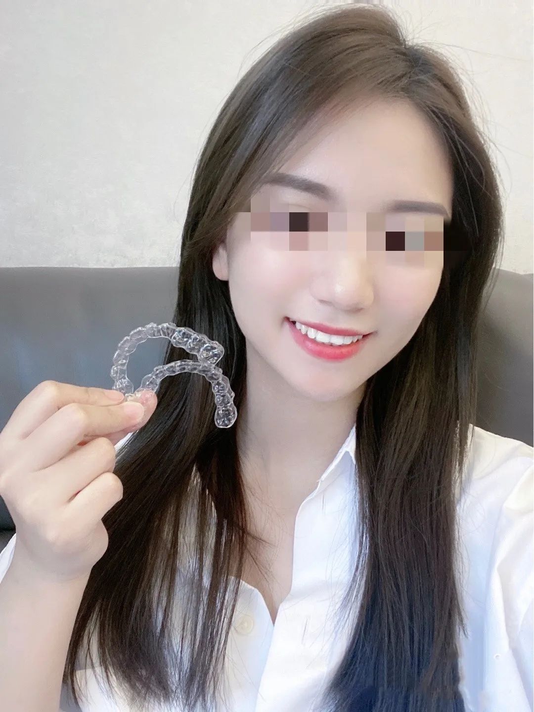 昆明龅牙矫正要多少钱,长沙轻微龅牙矫正要多少钱