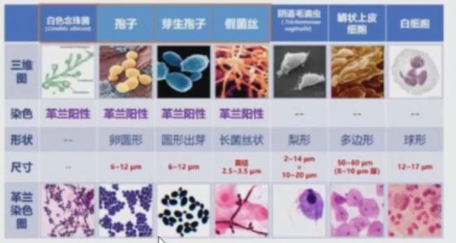 澶栭槾鍑虹幇闂,澶栭槾绱婁贡