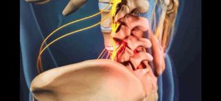 腰痛的真正原因是什么,腰痛要警惕五种原因