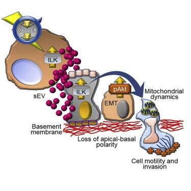 「Cell子刊」乳腺癌细胞利用外囊泡“对话”挟持正常细胞