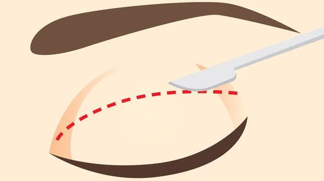 想做医美需要具备什么条件,医美为什么那么多避雷的