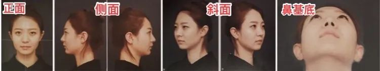 想做医美需要具备什么条件,医美为什么那么多避雷的