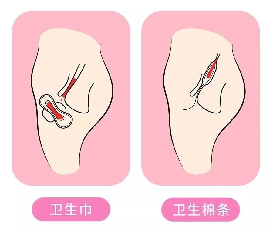 生理期姨妈巾好用推荐,比姨妈巾更好用的东西