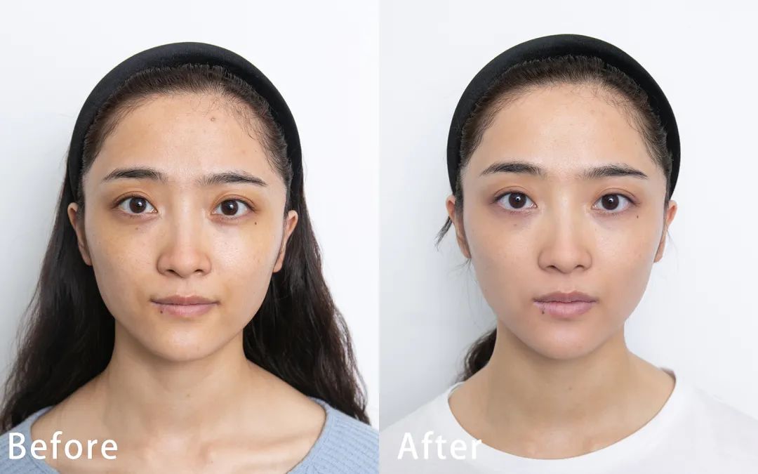 家用注氧仪到底有没有效果,日本谷心注氧仪真的有用么