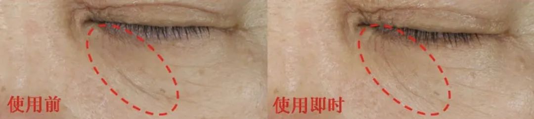 空瓶眼霜回购,无限回购的一款国货眼霜