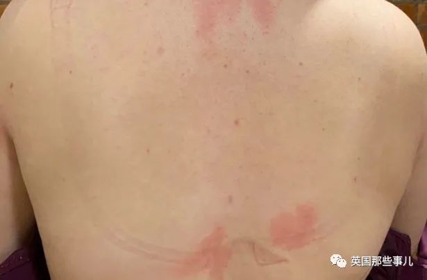 有一对J*杯罩**“卡通胸”是什么feel？妹子表示：太痛苦！很辛苦