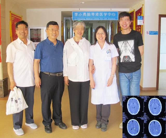 脑积水腹腔分流术后头晕头痛,脑积水分流术后发烧会有什么后果