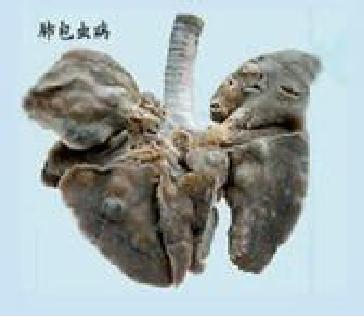 地方病防治宣传核心信息—碘缺乏病、包虫病、地方性氟中毒