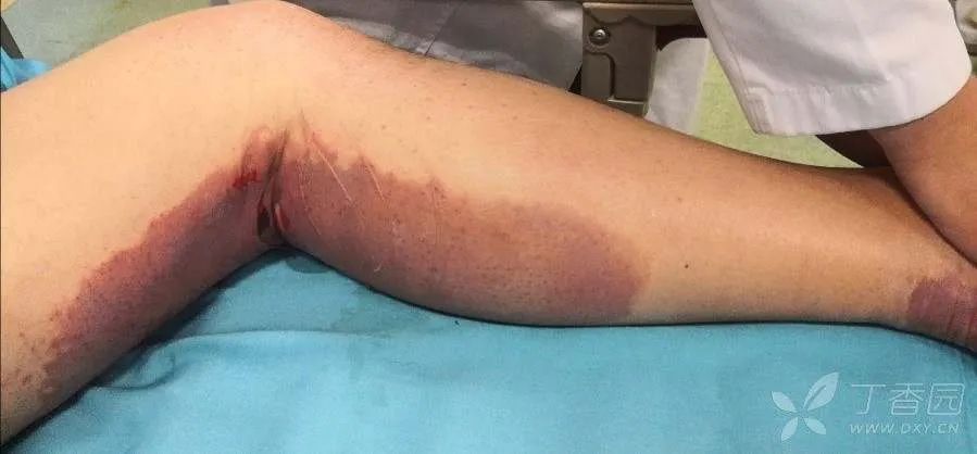 24岁小伙喝下安眠药后续,小伙吃安眠药睡觉