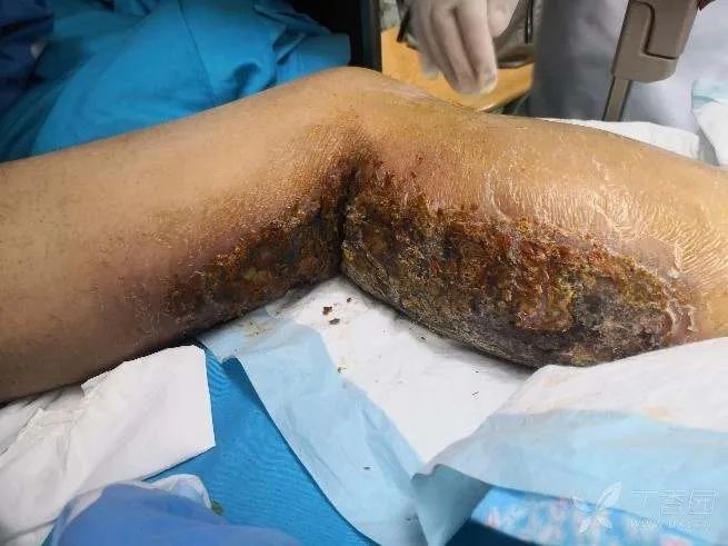 24岁小伙喝下安眠药后续,小伙吃安眠药睡觉