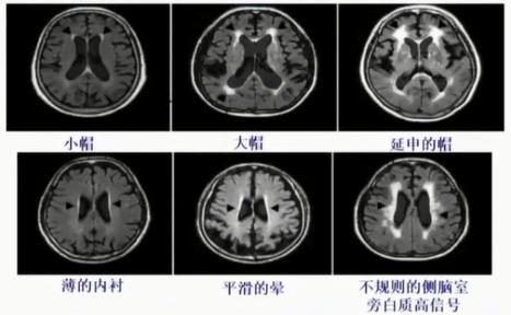 徐运神经内科,徐运医生怎么样