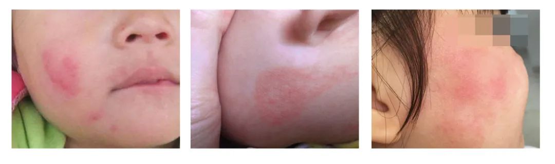 冬天宝宝脸干燥可以涂什么护肤品,儿童护肤冬季防皲裂