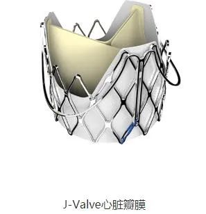 心脏介入瓣膜领军企业杰成医疗将解散？