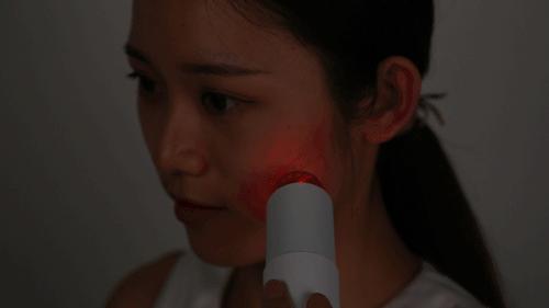 痘痘挤出的白米粒是什么,痘痘挤出来的白色乳浆是什么