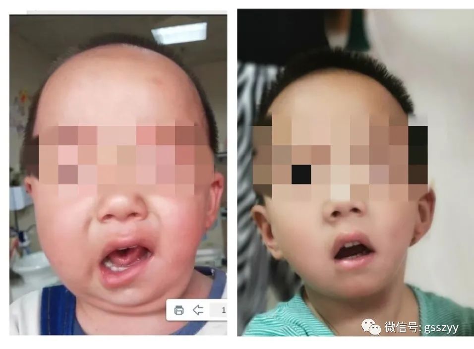 儿科专病门诊有哪些,小儿推拿中心专病门诊