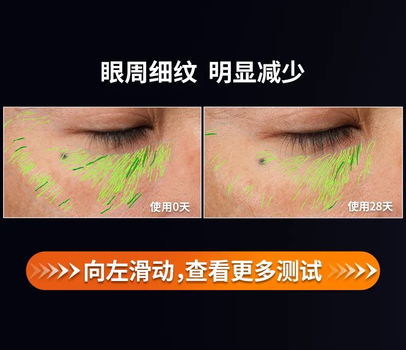 射频美容仪到底怎样,射频美容仪合格吗