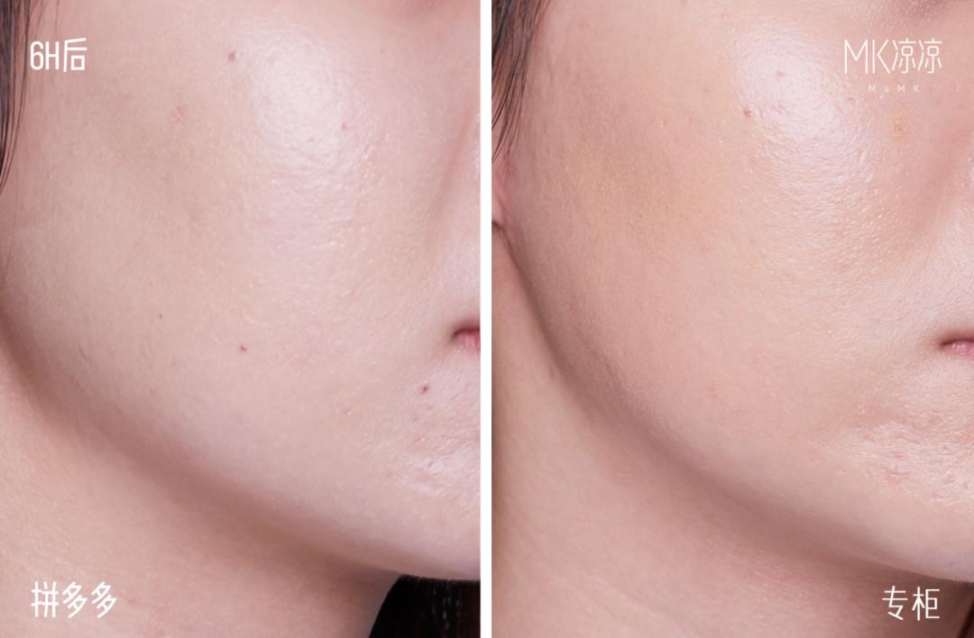 拼多多上的骨折骨裂膏有用吗,拼多多上的便宜药靠谱吗