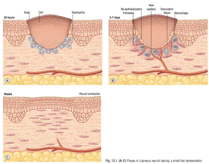 炎症的自述：发生、机理和结局