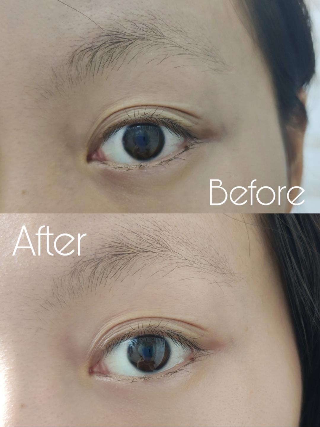 欧阳娜娜关晓彤眼霜,欧阳娜娜眼霜去黑眼圈