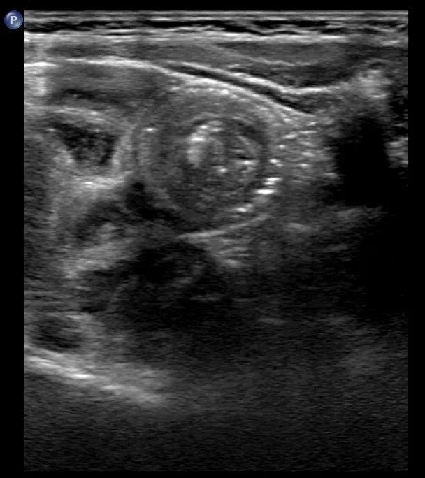 惊呆！就这一会儿，可好了？