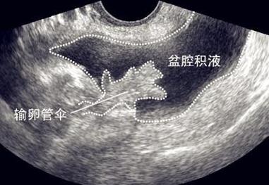 女人一定要知道的10个妇科小常识,女性必知的8条妇科常识