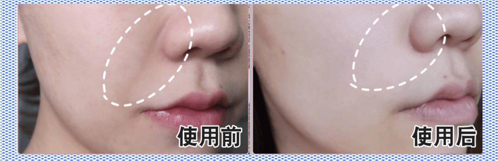 小红书电动牙刷,70元左右电动牙刷