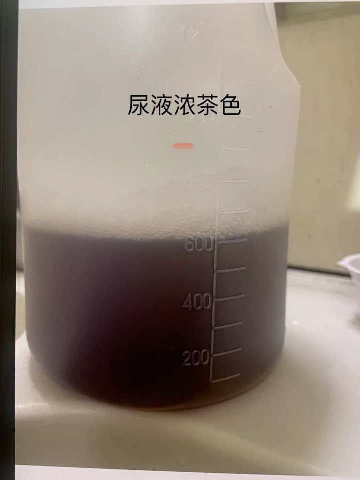 初一男孩身高1.67,初一男孩身高1.65