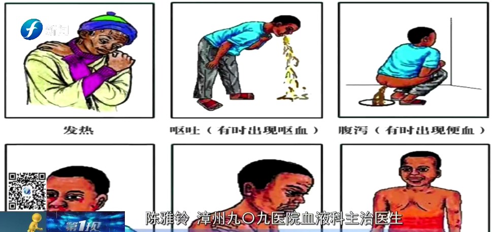 漳州一女子出现高烧、畏寒还眼睛发红，原来是接触了它