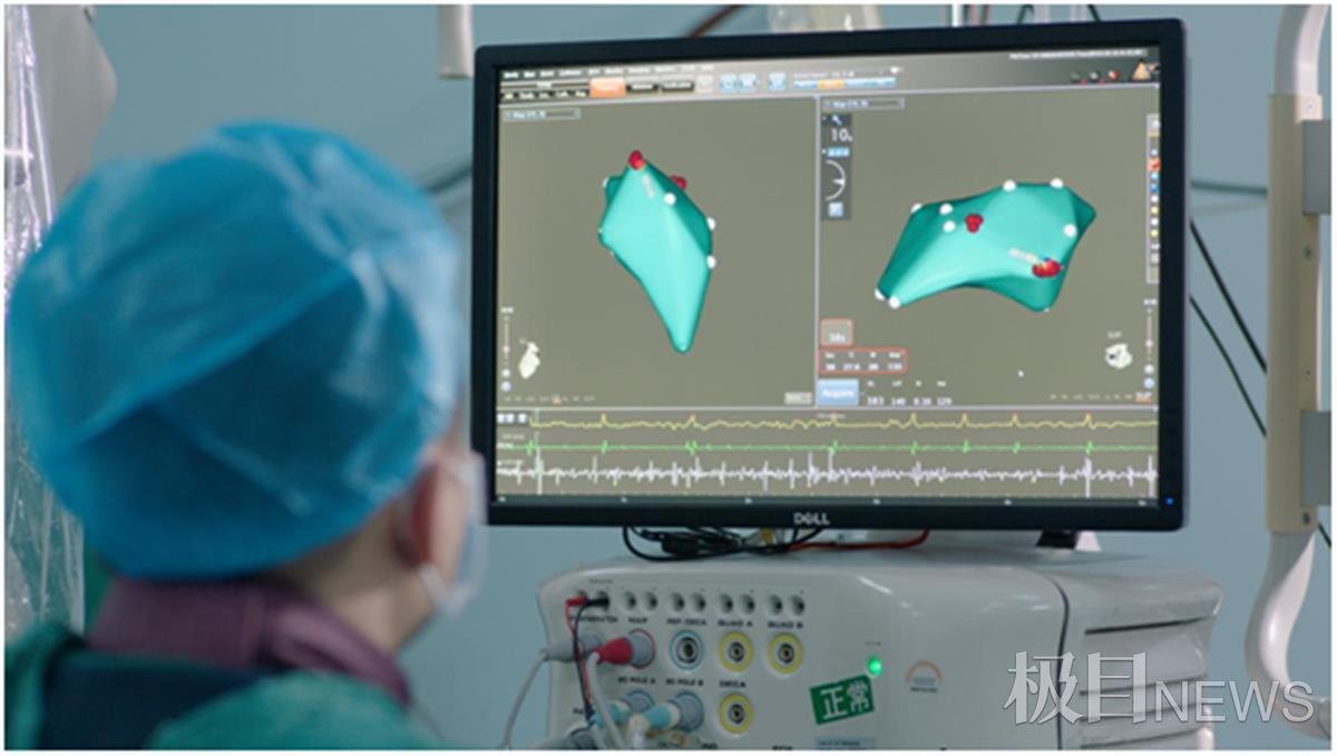 心脏有时像打鼓一样敲几下,心脏突然砰砰乱跳如何缓解