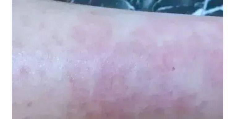 j-style脱毛仪测评,j-style美容仪好用吗