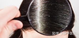 有这几个情况说明你该清理螨虫了,头皮上长小红疙瘩是螨虫导致的吗