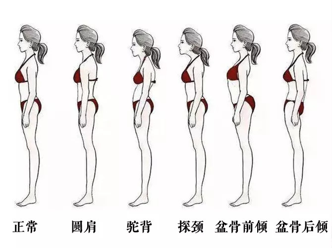 十分钟告别含胸驼背,5个动作改善含胸驼背
