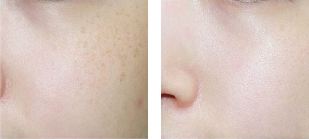 真正美白效果好的平价面膜,不输大牌20种平价面膜