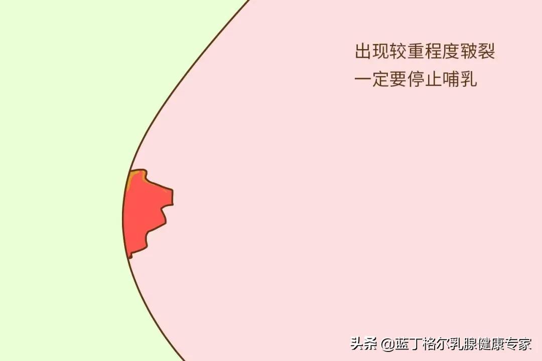 让女人心寒的是什么东西,让女人真正感到心寒的是什么