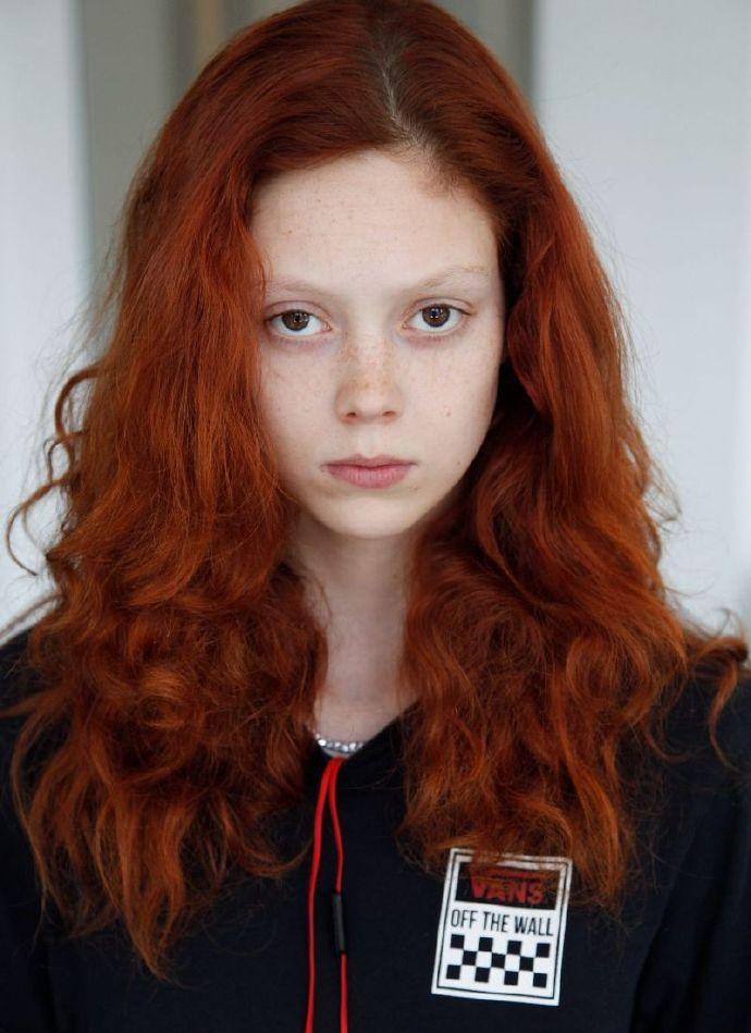 跨性别者服用雌激素变化,跨性别吃的激素