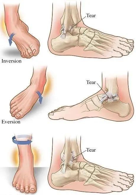 跑步者怎样进行力量训练的视频,如何练就一个正确的跑步姿势