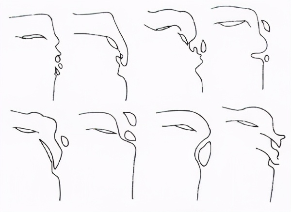 青少年无缘无故的腿疼,青少年腿疼怎么办