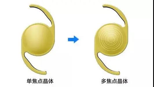 高岩院长做客健康时间——手术治疗白内障的最佳时期是什么时候？