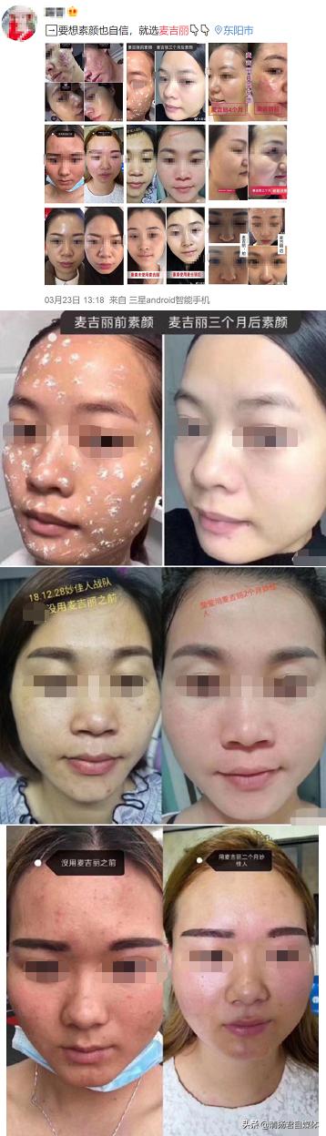 麦吉丽为何在微商手里买便宜,微商麦吉丽