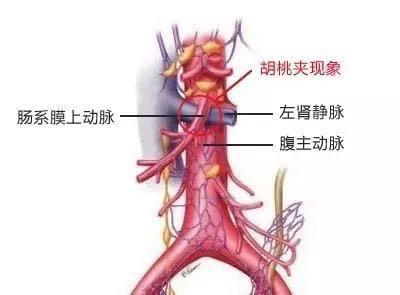 小儿血尿能彻底治愈吗,小儿血尿