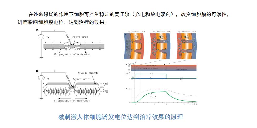 拒绝侵入式盆底肌刺激！让治疗更加舒适人性化的一款神器来了