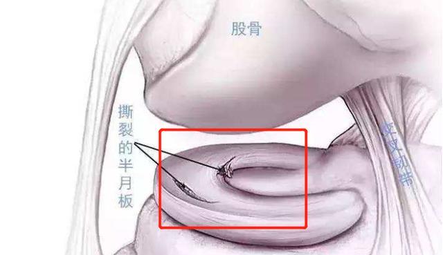 膝盖疼痛可能有三种病不要吃药,膝盖疼痛不要吃什么