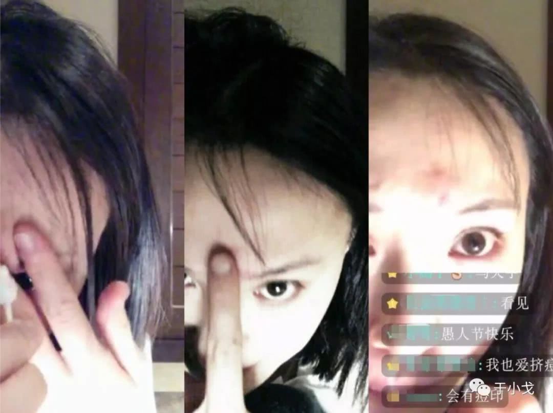 黑头挤到一半挤不出来,黑头挤不完吗