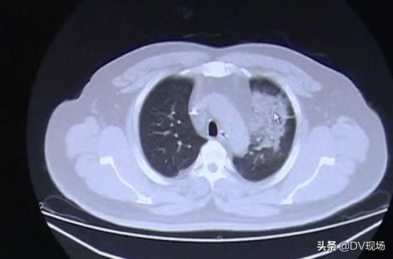 喝自己泡的果酒中毒,自己泡的水果酒有什么危害